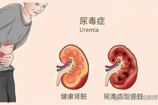 球迷批奥纳纳表现：他的站位就是在犯罪，让科曼完成最轻松射门